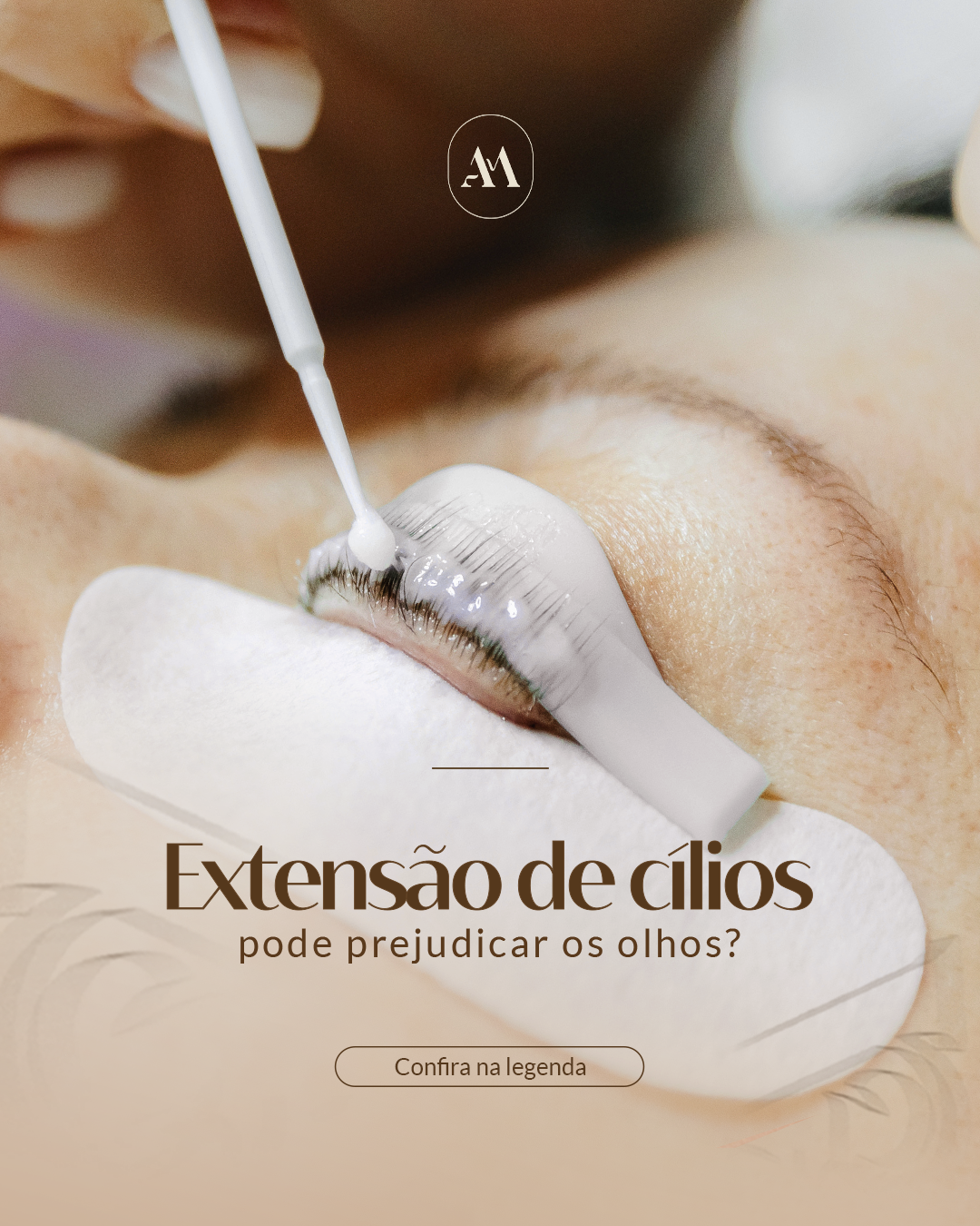 Quando estética vira risco: o alerta sobre procedimentos próximos aos olhos