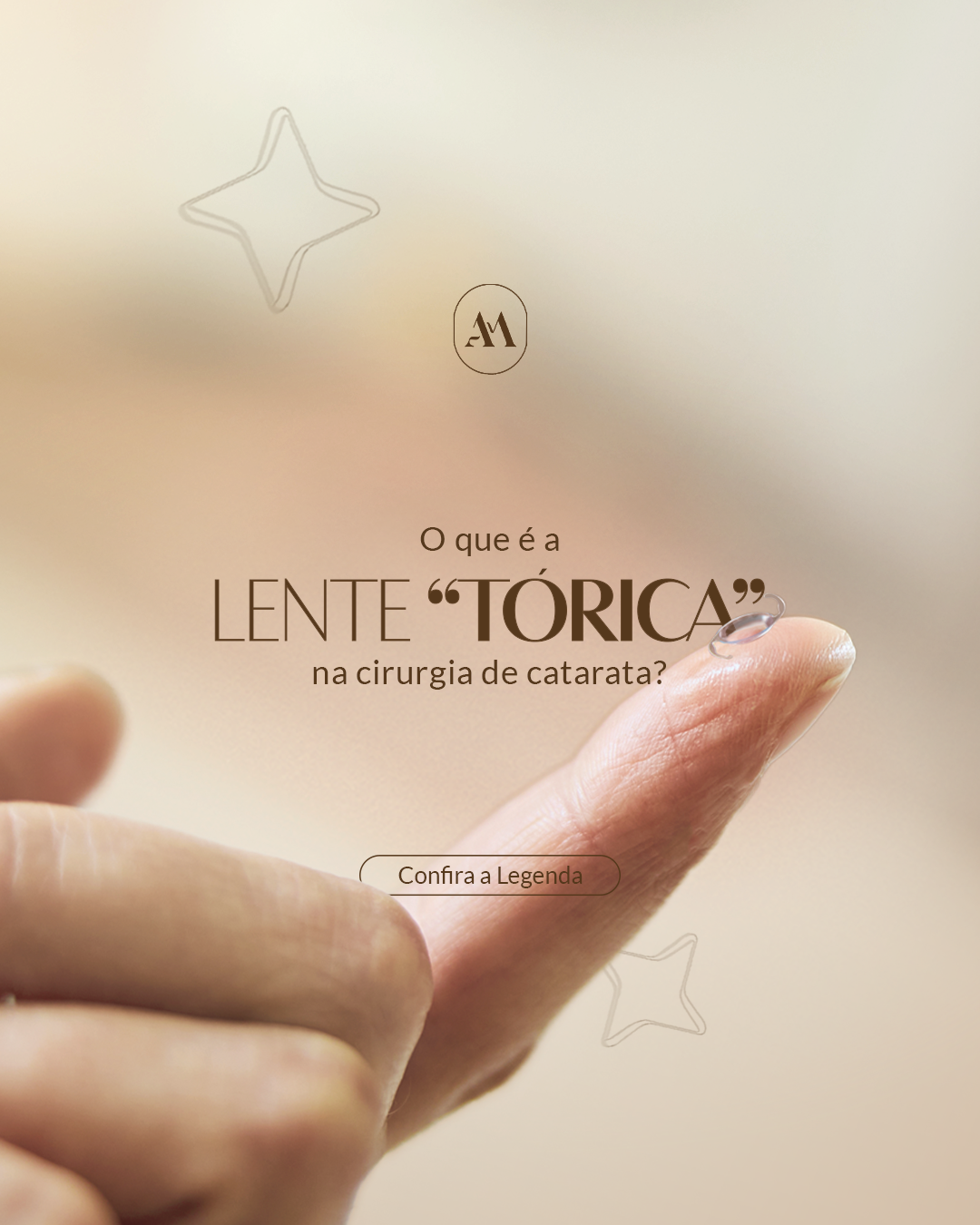 Lente Tórica: A Personalização da Cirurgia de Catarata para Quem Tem Astigmatismo